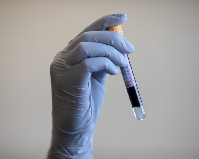 uk-report-finds-decades-long-infected-blood-scandal-was-covered-up