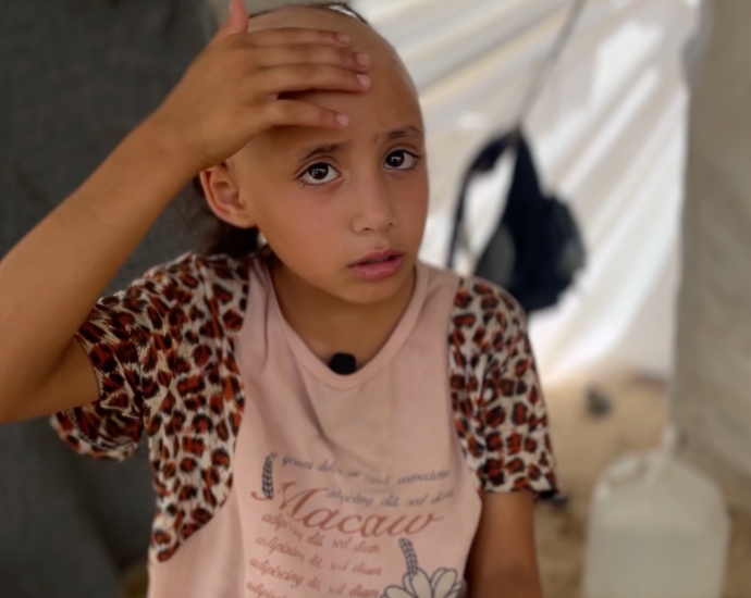 palestinian-girl-describes-losing-her-hair-over-war-trauma