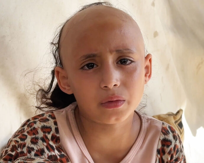 ‘psychologically-broken,’-8-year-old-sama-loses-her-hair