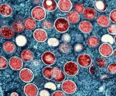 two-additional-cases-of-new-mpox-strain-diagnosed-in-britain