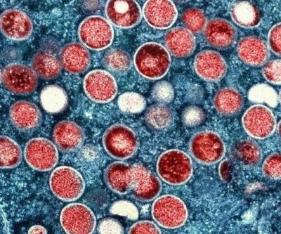 first-human-case-of-new-mpox-virus-detected-in-britain