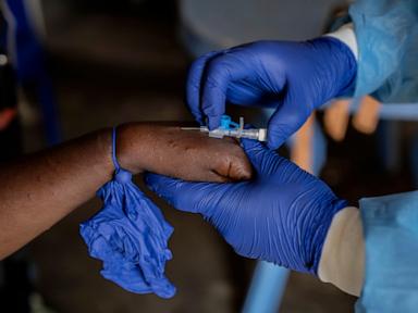 un-authorizes-first-mpox-vaccine-for-children-in-an-attempt-to-control-congo-outbreak