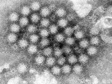 nasty-norovirus-is-back-in-full-force-with-us-cases-of-the-stomach-virus-surging