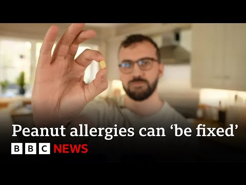 how-a-man-with-life-threatening-peanut-allergy-now-eats-them-every-day-|-bbc-news