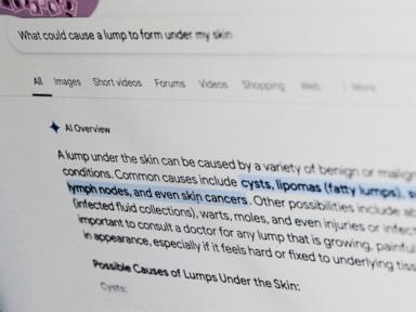 what’s-that-rash?-put-some-thought-into-asking-google-for-medical-help