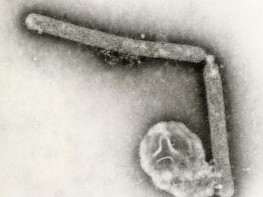 the-us-hasn’t-seen-a-human-bird-flu-case-in-3-months.-experts-are-wondering-why