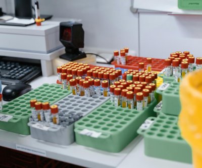 new-blood-test-screens-for-thousands-of-rare-inherited-diseases-at-once