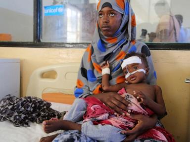 us-aid-kept-many-hungry-somali-children-alive.-now-that-money-is-disappearing
