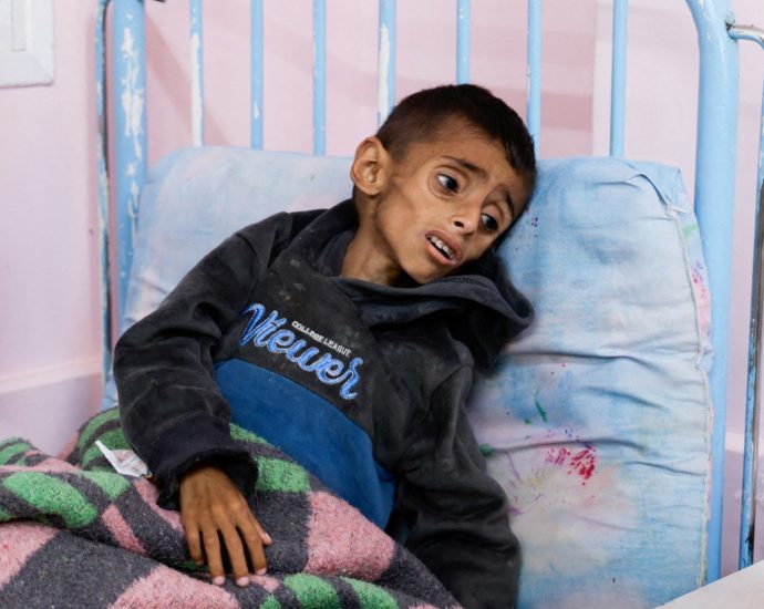 gaza-mother-pleads-for-help-to-save-emaciated-5-year-old