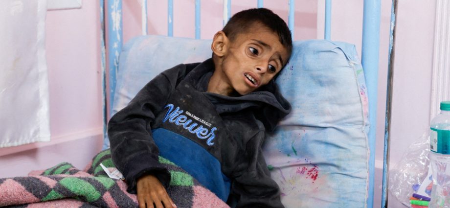 gaza-mother-pleads-for-help-to-save-emaciated-5-year-old