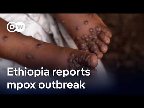 ethiopia-reports-reports-first-mpox-cases-and-death-|-dw-news