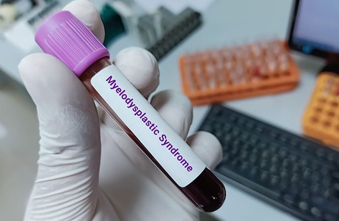 Immune Modulation in MDS: Our Core Strategies Need to Change