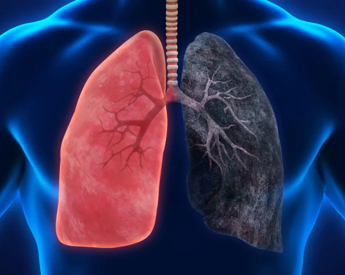 fire-smoke-exposure-leaves-toxic-metals-and-lasting-immune-changes