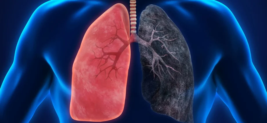 fire-smoke-exposure-leaves-toxic-metals-and-lasting-immune-changes