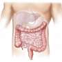 Healthy lifestyle linked to lower diverticulitis risk, irrespective of genetic susceptibility