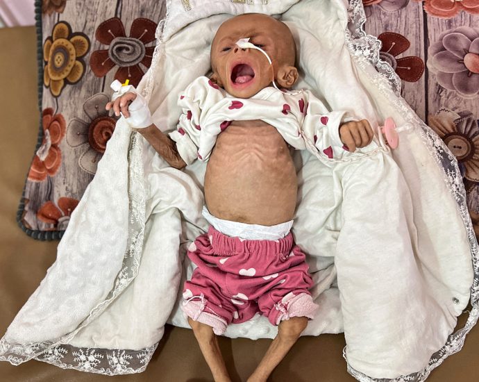 un-agency-sounds-alarm-as-1-in-10-children-in-gaza-now-malnourished