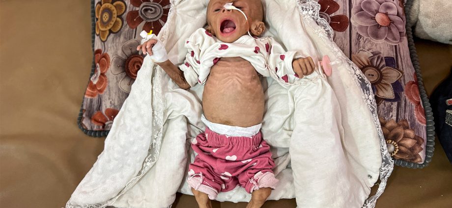 un-agency-sounds-alarm-as-1-in-10-children-in-gaza-now-malnourished