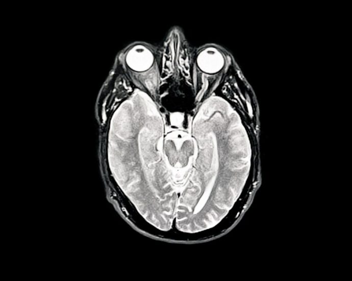 ai-pen-can-detect-parkinson’s-disease-through-handwriting