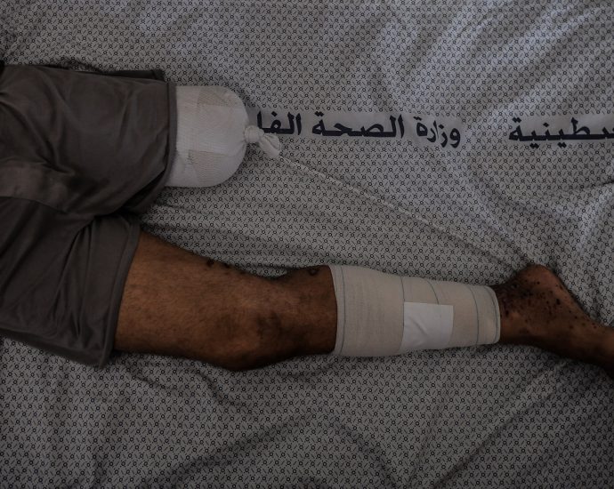 in-gaza,-death-seems-easier-than-amputation