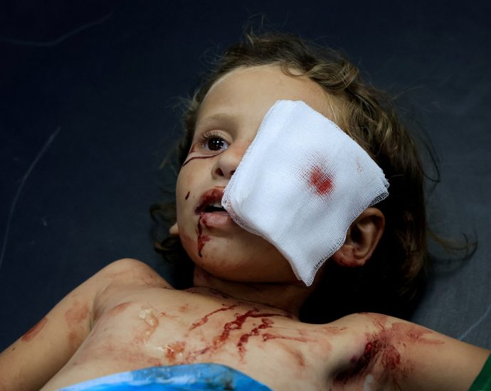 i-was-training-to-heal-eyes-in-gaza.-then-everything-went-dark