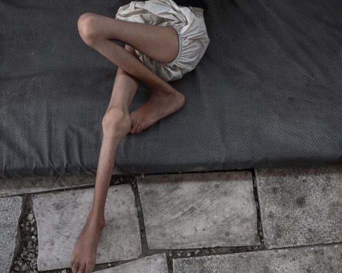 israelis-rebuff-the-traitor,-insisting-images-of-starvation-in-gaza-are-‘fake’