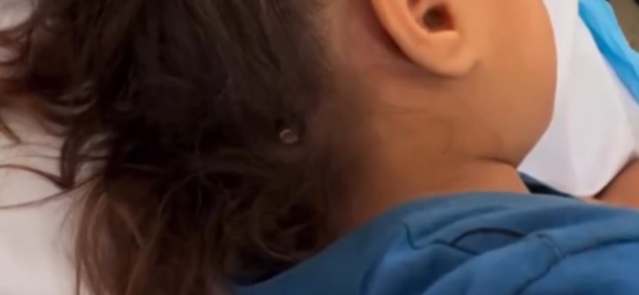 gaza-child-in-hospital-with-israeli-bullet-protruding-from-her-skull
