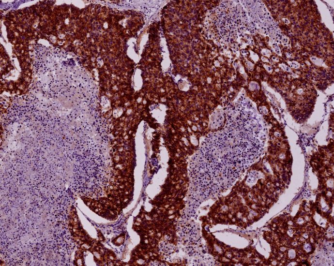 sweet-cure?-sugar-substitute-may-give-cancer-a-run-for-its-money,-study-hints
