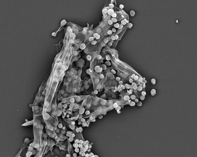 scientists-just-found-a-hidden-factor-behind-earth’s-methane-surge