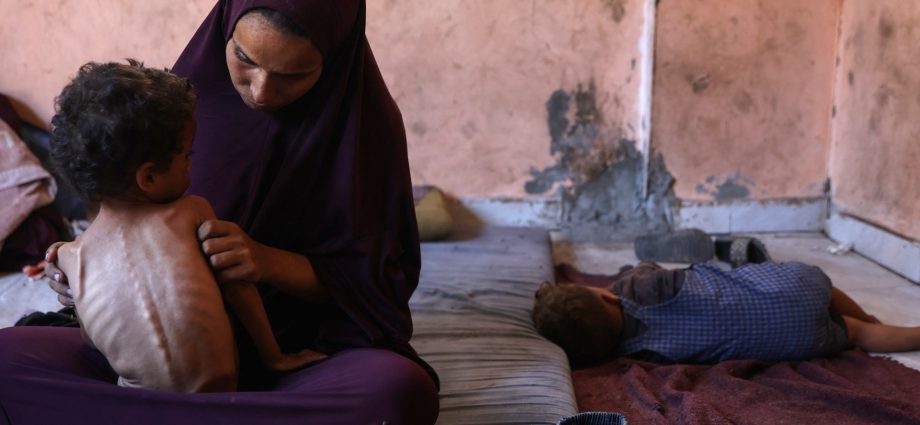 amid-gaza-famine,-palestinian-girl-struggles-to-survive