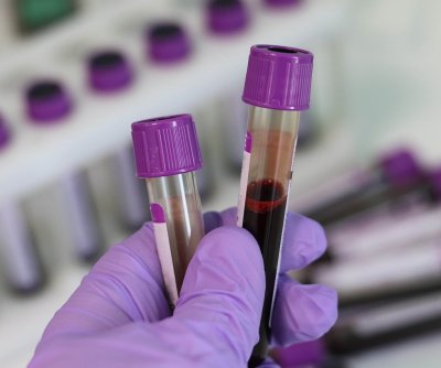 study-shows-ai-can-hone-in-on-genetic-risks-for-10-inherited-diseases