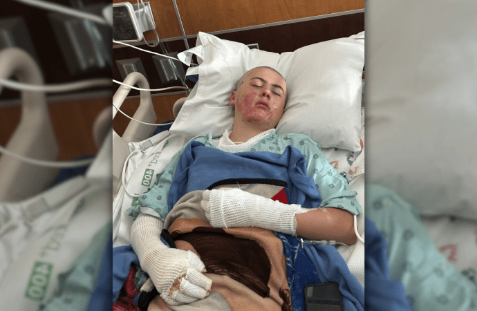 texas-boy-hospitalized-after-tiktok-experiment-goes-wrong