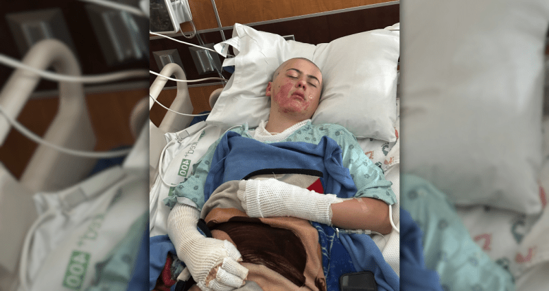 texas-boy-hospitalized-after-tiktok-experiment-goes-wrong