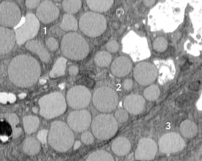 cells-“vomit”-waste-in-a-hidden-healing-shortcut-that-could-also-fuel-cancer