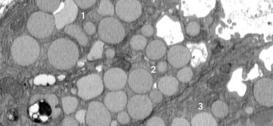 cells-“vomit”-waste-in-a-hidden-healing-shortcut-that-could-also-fuel-cancer