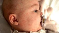 vaccination-plea-after-baby’s-‘terrifying’-measles