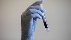 error-leaves-diabetes-patients-needing-new-tests