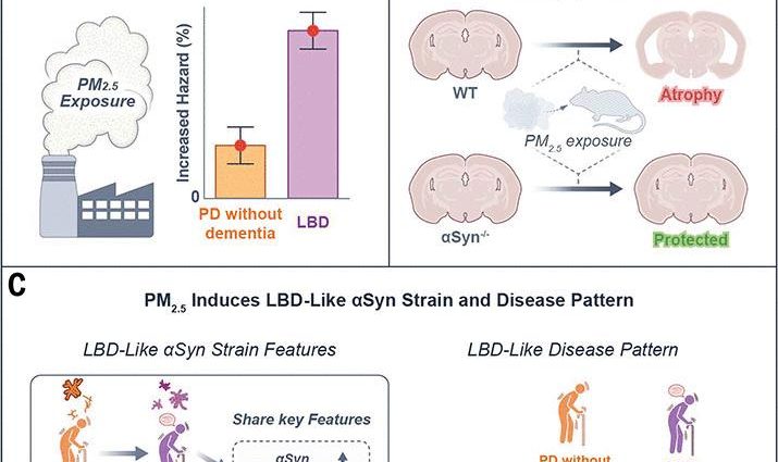 Lewy body dementia promotion by air pollutants | Science