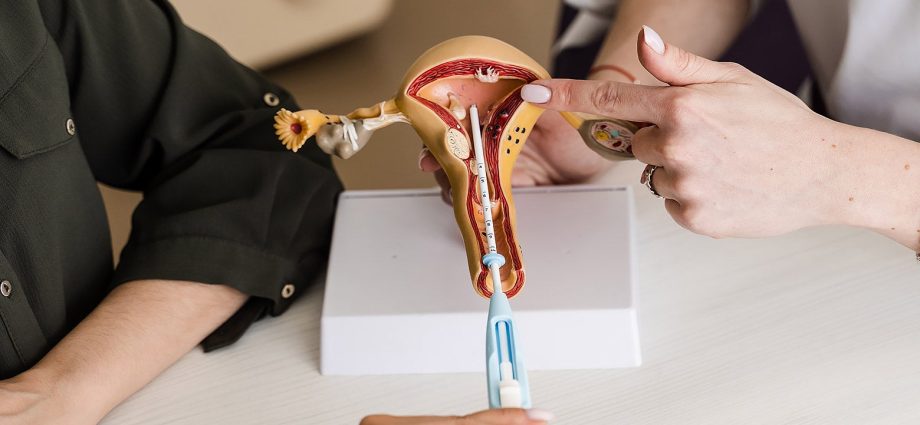 There’s a Secret to a Nearly Painless IUD. Republicans Can’t Stand It.