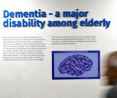 uk.-gene-therapy-trial-effectively-treats-huntington’s-disease