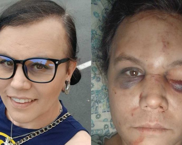 25-year-old-man-pleads-not-guilty-to-violent-assault-on-trans-woman-nikki-armstrong