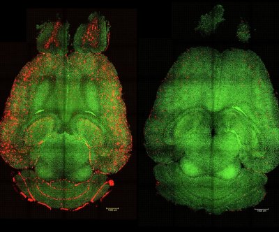 scientists-use-nanoparticles-to-clear-alzheimer’s-brain-plaque-in-mice