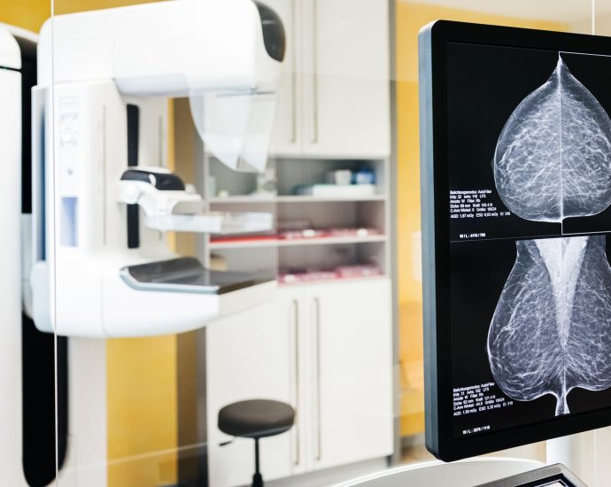 early-detection-and-healthy-habits-key-in-fight-against-breast-cancer