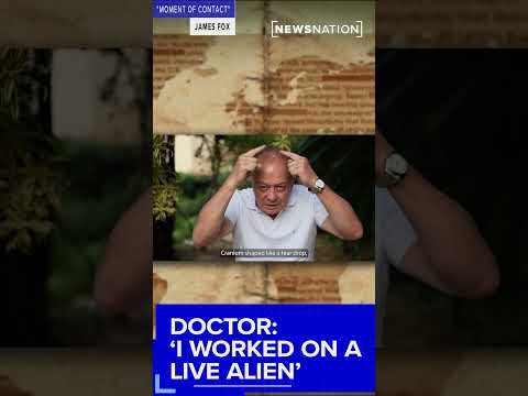 doctor:-‘i-worked-on-a-live-alien’