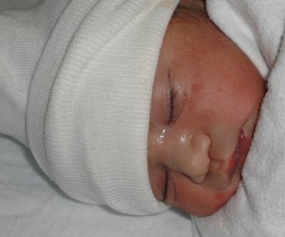 byheart-recalls-all-infant-formula-amid-botulism-outbreak