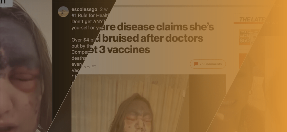 anti-vaccine-claims-about-the-alexis-lorenze-case-mislead-on-vaccine-risks