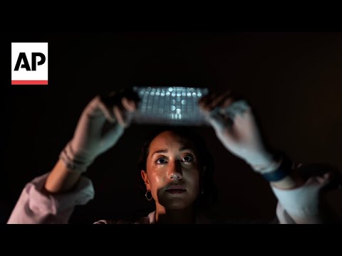 what-happens-when-your-immune-system-hijacks-your-brain