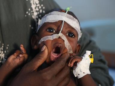 a-visit-to-somalia’s-crumbling-hospitals-shows-the-toll-of-aid-cuts-and-war