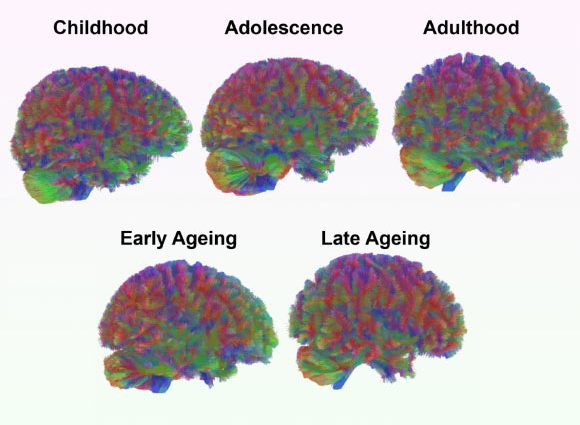 Neuroscientists Identify Five Major Epochs of Brain Structure over Course of Human Life