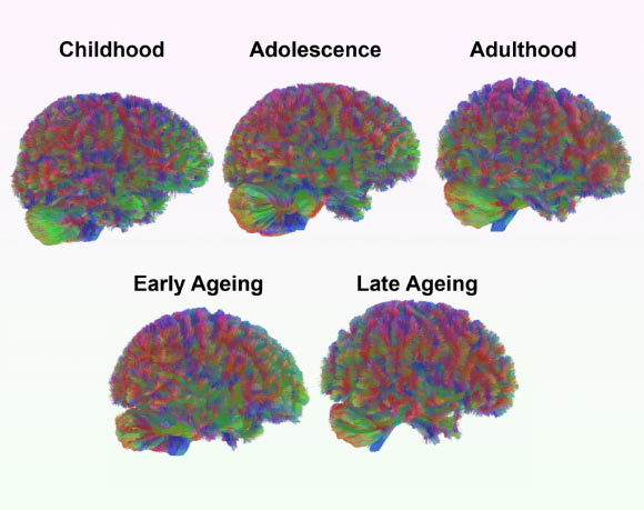 Neuroscientists Identify Five Major Epochs of Brain Structure over Course of Human Life