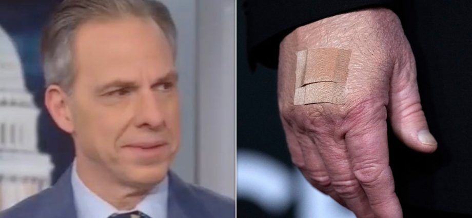 jake-tapper-rejects-white-house-reason-for-the-traitor’s-bruises:-‘there-is-something-going-on’